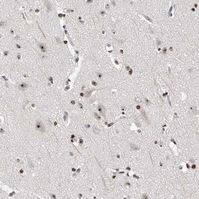 Immunohistochemistry-Paraffin: MPHOSPH10 Antibody [NBP1-84341]