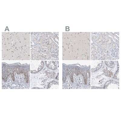 Immunohistochemistry-Paraffin: MPHOSPH10 Antibody [NBP1-84341]