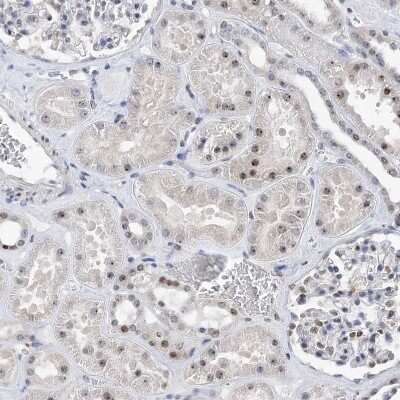 Immunohistochemistry-Paraffin: MPHOSPH10 Antibody [NBP1-84341]