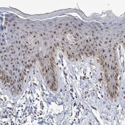 Immunohistochemistry-Paraffin: MPHOSPH10 Antibody [NBP1-84341]