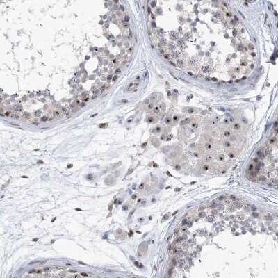 Immunohistochemistry-Paraffin: MPHOSPH10 Antibody [NBP1-84341]