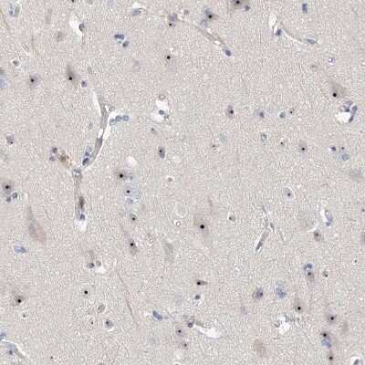 Immunohistochemistry-Paraffin: MPHOSPH10 Antibody [NBP2-38232]
