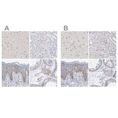 Immunohistochemistry-Paraffin: MPHOSPH10 Antibody [NBP2-38232]