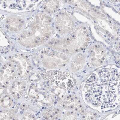 Immunohistochemistry-Paraffin: MPHOSPH10 Antibody [NBP2-38232]