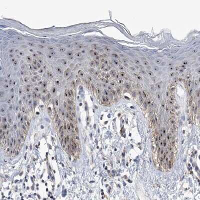 Immunohistochemistry-Paraffin: MPHOSPH10 Antibody [NBP2-38232]