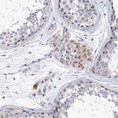 Immunohistochemistry-Paraffin: MPHOSPH10 Antibody [NBP2-38232]