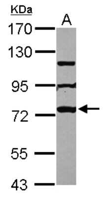 Western Blot: MPHOSPH10 Antibody [NBP2-19387]