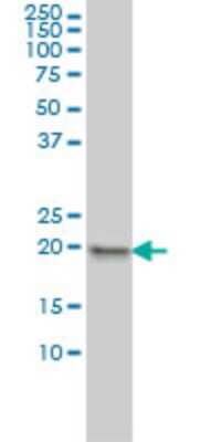 Western Blot: MPHOSPH6 Antibody (1D8-2A8) [H00010200-M01]