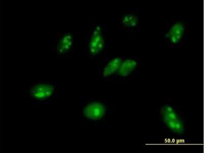 Immunocytochemistry/ Immunofluorescence: MPHOSPH6 Antibody [H00010200-B01P]