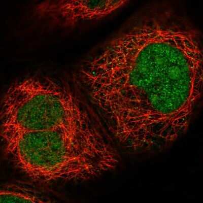 Immunocytochemistry/ Immunofluorescence: MPHOSPH6 Antibody [NBP1-82626]