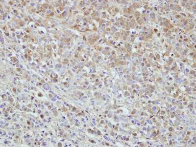 Immunohistochemistry-Paraffin: MPHOSPH6 Antibody [NBP2-19388]