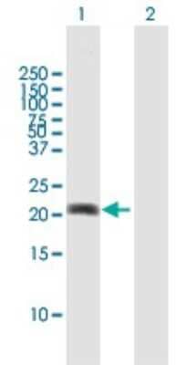 Western Blot: MPHOSPH6 Antibody [H00010200-B01P]