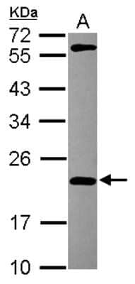 Western Blot: MPHOSPH6 Antibody [NBP2-19388]