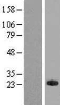 Western Blot: MPHOSPH6 Overexpression Lysate [NBL1-13198]