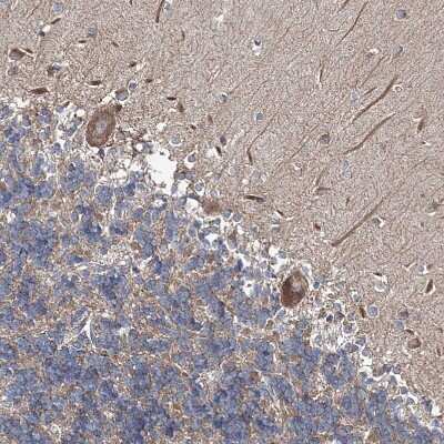 Immunohistochemistry-Paraffin: MPHOSPH9- Antibody [NBP1-87870]