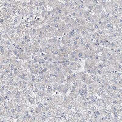 Immunohistochemistry-Paraffin: MPHOSPH9- Antibody [NBP1-87870]