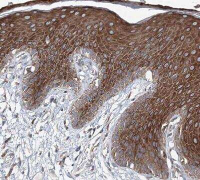 Immunohistochemistry-Paraffin: MPHOSPH9- Antibody [NBP1-87870]