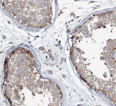 Immunohistochemistry-Paraffin: MPHOSPH9- Antibody [NBP1-87870]