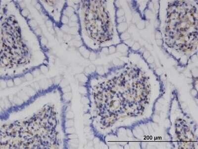 Immunohistochemistry-Paraffin: MPHOSPH9- Antibody (4E10) [H00010198-M10]