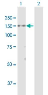 Western Blot: MPHOSPH9- Antibody [H00010198-B01P]