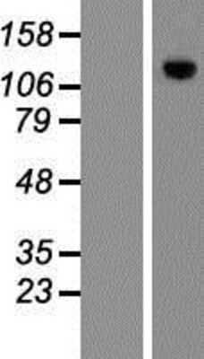 Western Blot: MPHOSPH9- Overexpression Lysate [NBP2-06408]