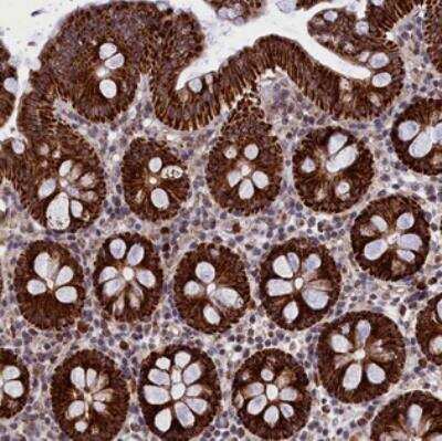 Immunohistochemistry-Paraffin: MPND Antibody [NBP2-31009]