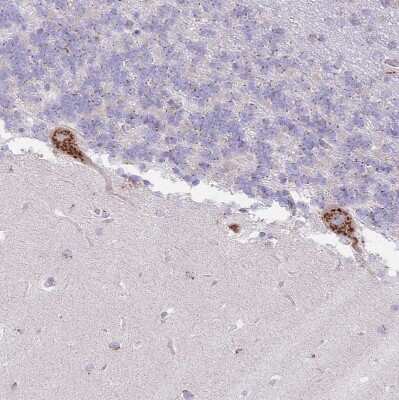 Immunohistochemistry-Paraffin: MPND Antibody [NBP2-30571]