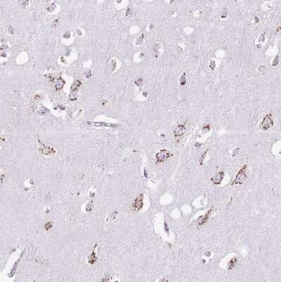 Immunohistochemistry-Paraffin: MPND Antibody [NBP2-30571]