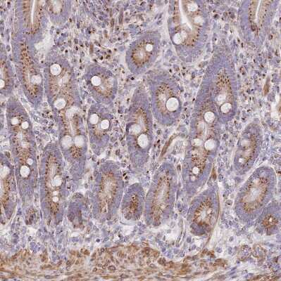 Immunohistochemistry-Paraffin: MPND Antibody [NBP2-30571]