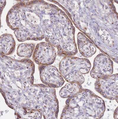 Immunohistochemistry-Paraffin: MPND Antibody [NBP2-30571]