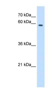 Western Blot: MPND Antibody [NBP1-79263]