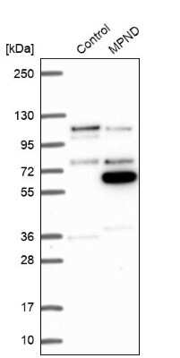 Western Blot: MPND Antibody [NBP2-31009]