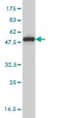 Western Blot: MPP1 Antibody (1C3-1D11) [H00004354-M02]