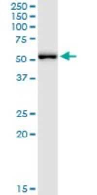 Western Blot: MPP1 Antibody (1E11-1G11) [H00004354-M01]