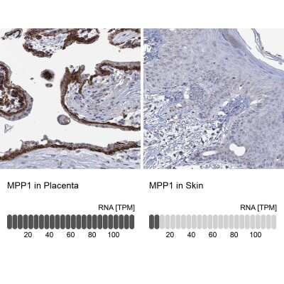 Immunohistochemistry-Paraffin: MPP1 Antibody [NBP3-17059]