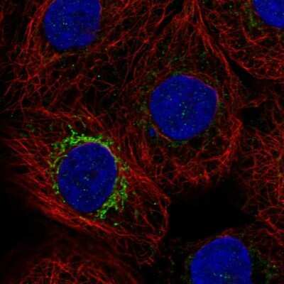 Immunocytochemistry/ Immunofluorescence: MPP2 Antibody [NBP1-85038]
