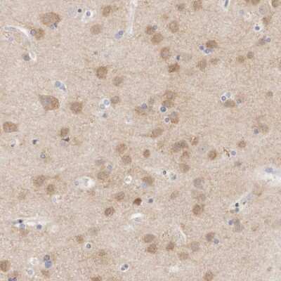 Immunohistochemistry-Paraffin: MPP2 Antibody [NBP1-85038]
