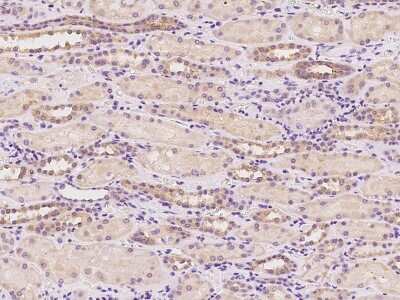 Immunohistochemistry-Paraffin: MPP2 Antibody [NBP2-97850]