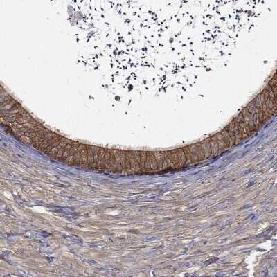 Immunohistochemistry-Paraffin: MPP2 Antibody [NBP3-17060]