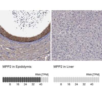 Immunohistochemistry-Paraffin: MPP2 Antibody [NBP3-17060]