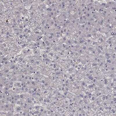 Immunohistochemistry-Paraffin: MPP2 Antibody [NBP3-17060]