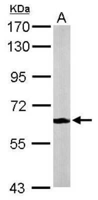Western Blot: MPP2 Antibody [NBP1-32393]