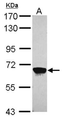 Western Blot: MPP2 Antibody [NBP1-32393]