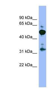 Western Blot: MPP2 Antibody [NBP1-54861]