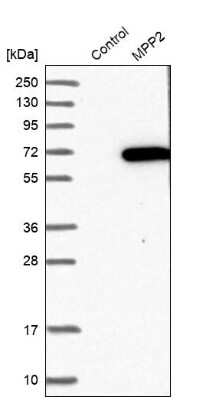 Western Blot: MPP2 Antibody [NBP1-85038]