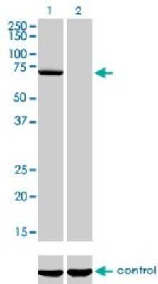 Western Blot: MPP3 Antibody (4D7) [H00004356-M01]