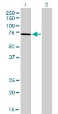 Western Blot: MPP3 Antibody (4D7) [H00004356-M01]