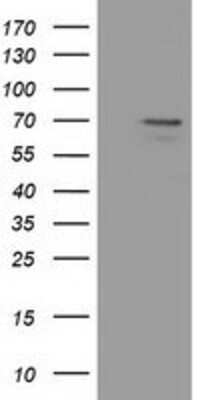 Western Blot: MPP3 Antibody (OTI8F1) [NBP2-02659]