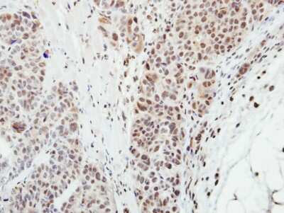 Immunohistochemistry-Paraffin: MPP3 Antibody [NBP1-32669]