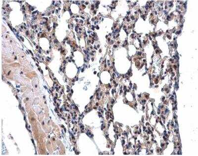Immunohistochemistry-Paraffin: MPP3 Antibody [NBP1-32669]
